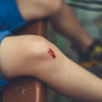 Legal Representation in Injury Claims: Benefits of Hiring a Personal Injury Attorney